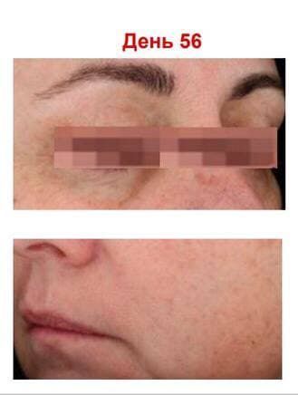 Антиоксидантна пептидна сироватка з вітаміном С Hillary Antioxidant Age Reverse Serum 30+, 30 мл HI-08-180 фото