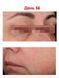 Антиоксидантна пептидна сироватка з вітаміном С Hillary Antioxidant Age Reverse Serum 30+, 30 мл HI-08-180 фото 12
