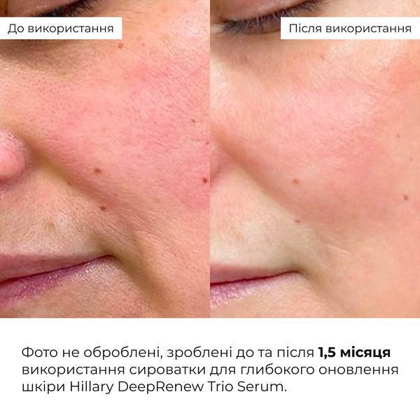 Набір для інтенсивного зволоження Hillary Intensive Hydration Kit K-11-858 фото