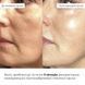 Комплекс для боротьби з набряками і тьмяності шкіри Hillary Anti-Puffiness & Dullness Skin Care Complex K-11-575 фото 2