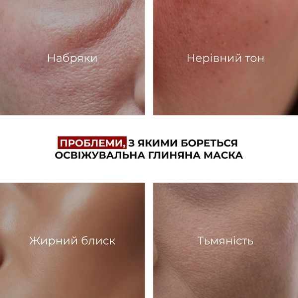 Комплекс для зменшення набряків та відновлення мікроциркуляції шкіри Hillary Anti-Puffiness & Microcirculation Recovery Complex K-11-919 фото