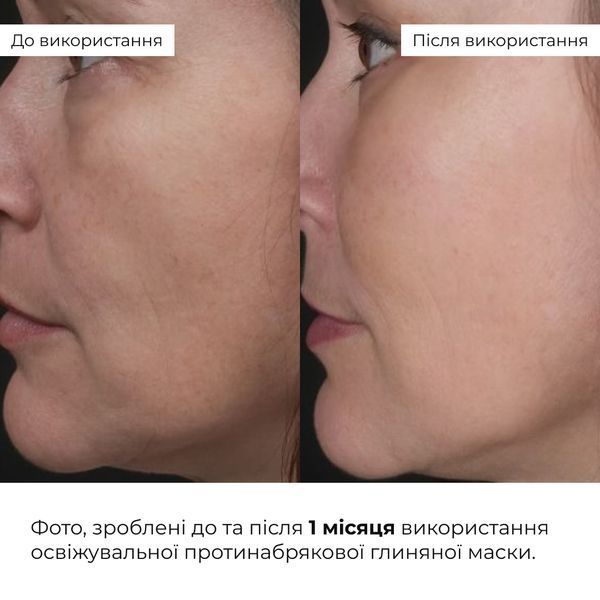 Комплекс для зменшення набряків та відновлення мікроциркуляції шкіри Hillary Anti-Puffiness & Microcirculation Recovery Complex K-11-919 фото