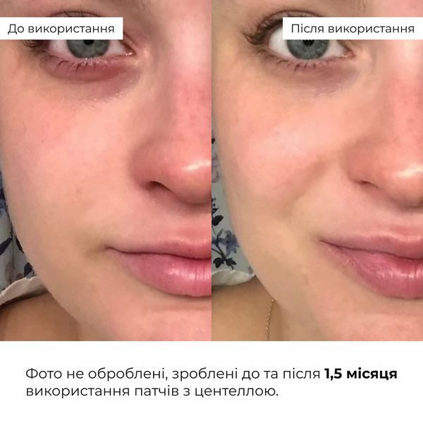 Набір для експрес-відновлення та зняття набряків Hillary Express Recovery & Anti-Puffiness Set K-11-940 фото