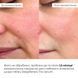 Комплекс базового догляду для оновлення та захисту шкіри Hillary Basic Care Skin Renewal & Protection Set K-11-002 фото 2