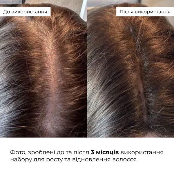 Кондиціонер для росту волосся Hillary Hop Cones & B5 Hair Growth Invigorating, 500 мл HI-07-540 фото