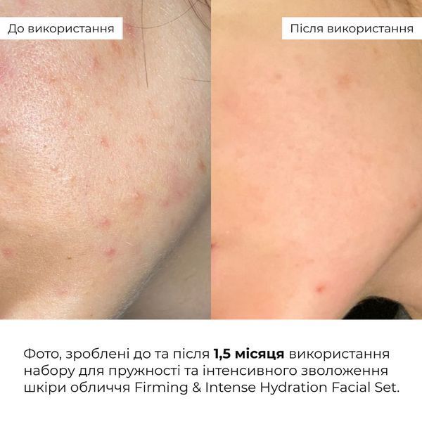 Набір для пружності та інтенсивного зволоження шкіри обличчя Hillary Firming & Intense Hydration Facial Set K-11-468 фото