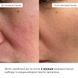 Набір із ніацинамідом проти запалень Hillary Niacinamide Anti-Inflammation Set K-11-341 фото 2