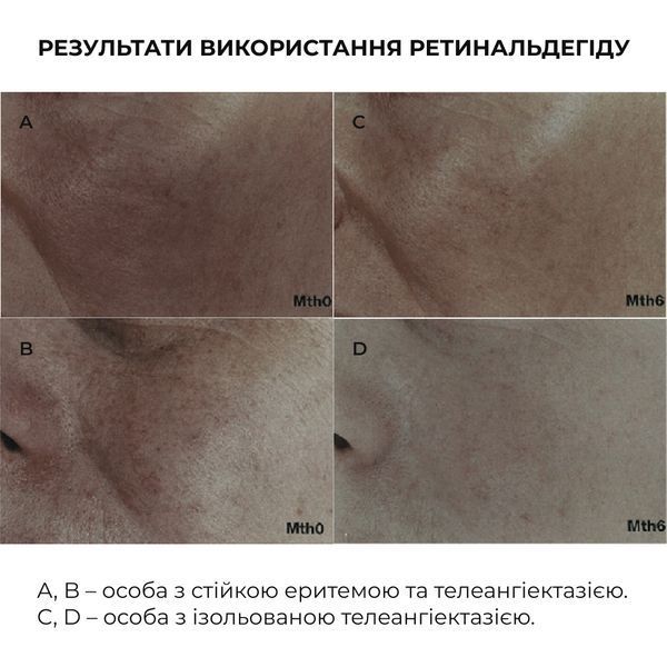 Комплекс для нічного оновлення та денного захисту шкіри Hillary Night Renewal & Day Protection Skin Complex K-11-003 фото