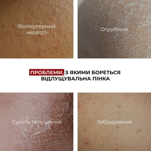 Мʼяка відлущувальна пінка з кислотами для тіла Hillary Soft Exfoliation AHA Body Foam, 150 мл HI-01-923 фото