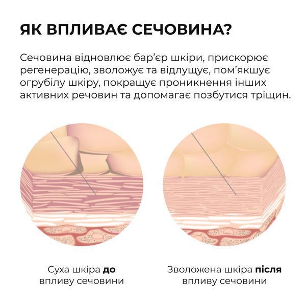 Мʼяка відлущувальна пінка з кислотами для тіла Hillary Soft Exfoliation AHA Body Foam, 150 мл HI-01-923 фото