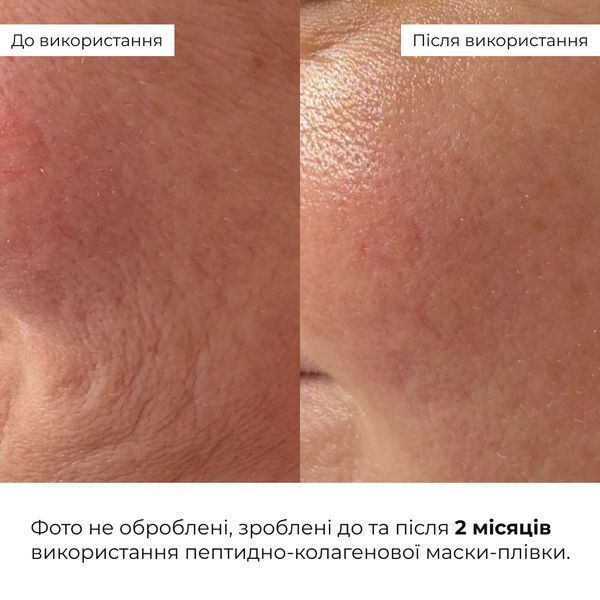 Набір для ліфтингу та розгладження шкіри обличчя Hillary Face Lifting & Smoothing Kit Hillary K-11-387 фото