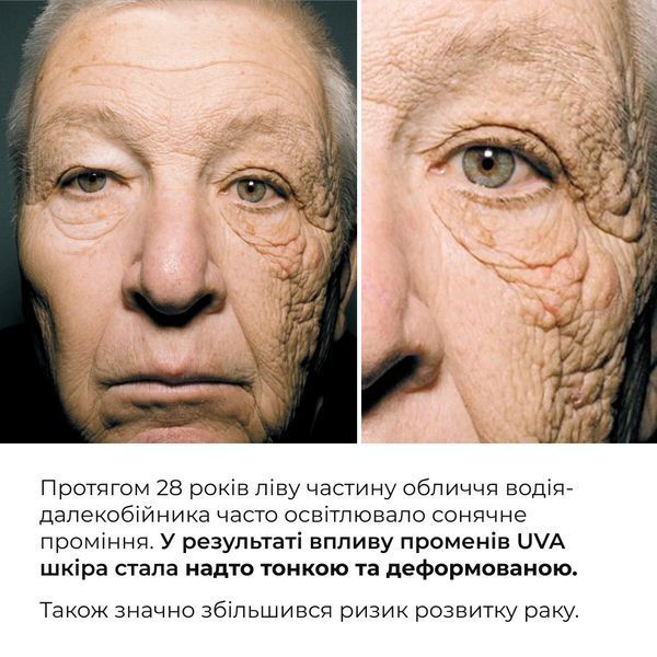 Комплекс для освітлення пігментних плям та захисту шкіри Hillary Dark Spot Brightening & Skin Protection Complex K-11-352 фото