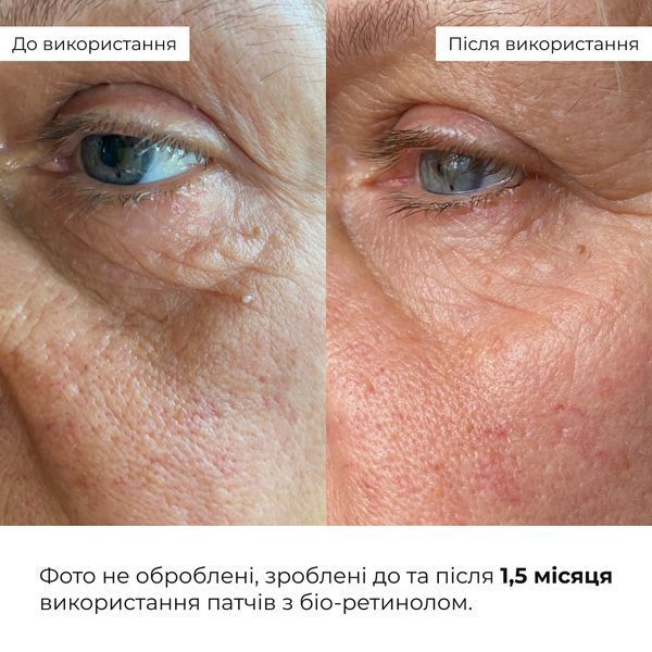 Набір для ліфтингу та розгладження шкіри обличчя Hillary Face Lifting & Smoothing Kit Hillary K-11-387 фото