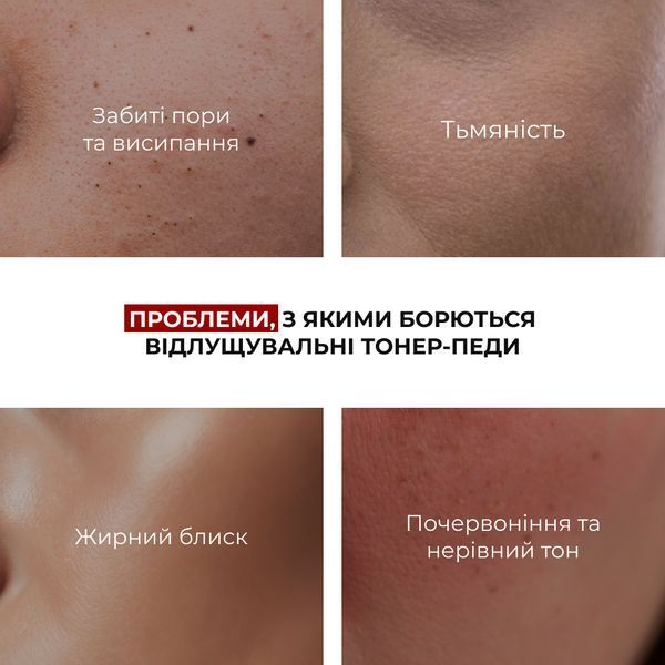 Комплекс для освітлення пігментних плям та захисту шкіри Hillary Dark Spot Brightening & Skin Protection Complex K-11-352 фото