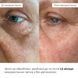 Набір для ліфтингу та розгладження шкіри обличчя Hillary Face Lifting & Smoothing Kit Hillary K-11-387 фото 7