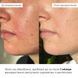 Ампульна сироватка з центеллою Hillary Ampoule Centella Serum, 30 мл K-08-674 фото 8