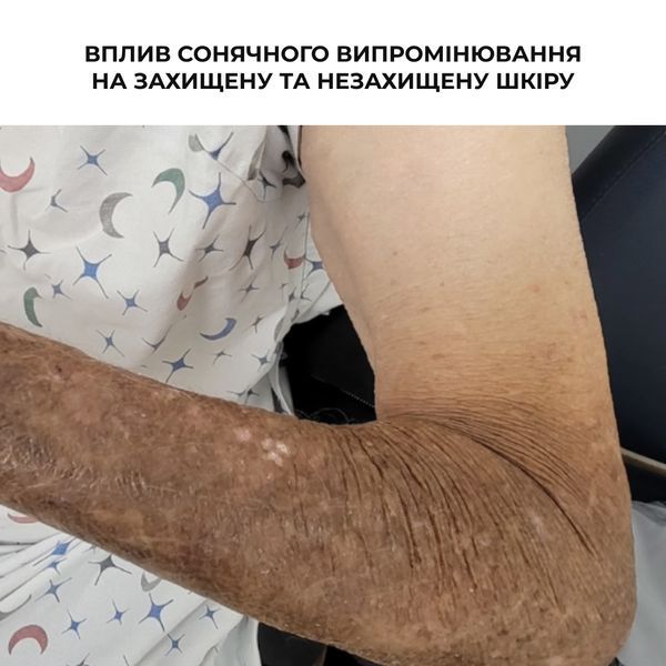 Набір для захисту та зволоження шкіри обличчя і тіла з вітаміном С Hillary Face & Body Protection & Vitamin C Hydration Set K-11-620 фото