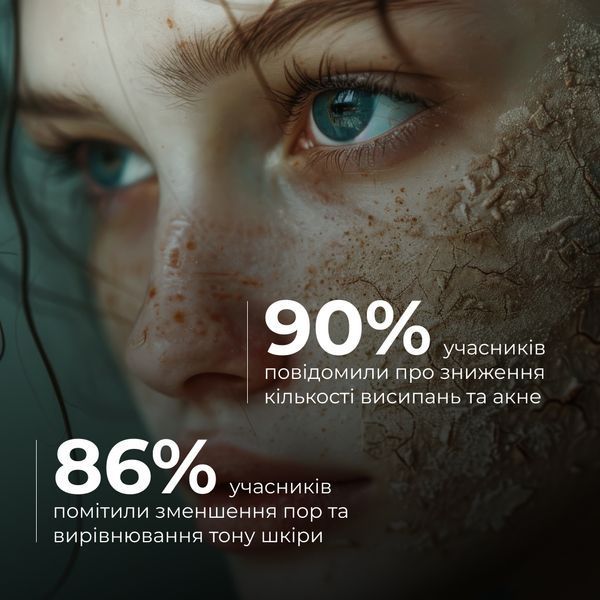 Набір інтенсивного догляду проти висипань та жирного блиску Hillary Intensive Anti-Blemish & Oil Control Set K-11-451 фото