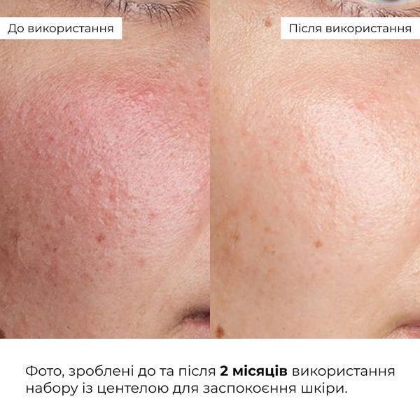 Комплекс антивікового догляду для підтримки бар&rsquo;єру та відновлення шкіри Hillary Anti-Age Barrier Support & Skin Recovery Complex K-11-425 фото