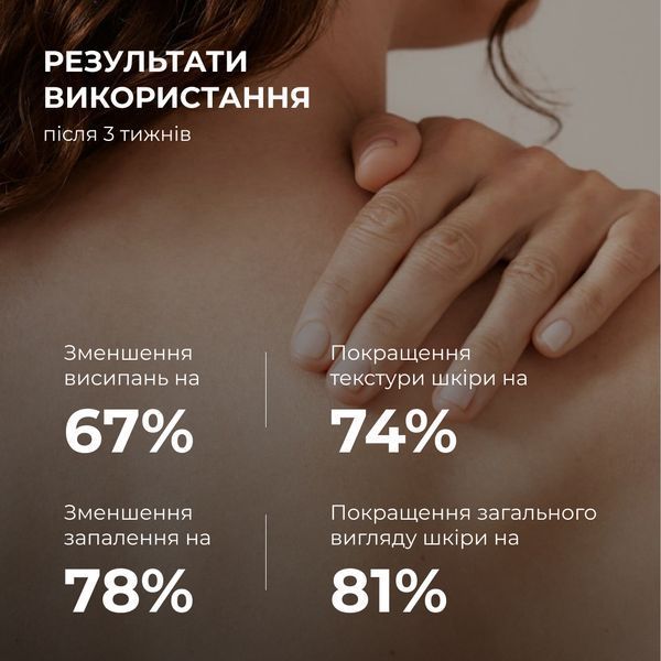 Сироватка для проблемної шкіри з саліциловою кислотою Hillary Back & Body Acne Control Serum, 50 мл HI-08-836 фото