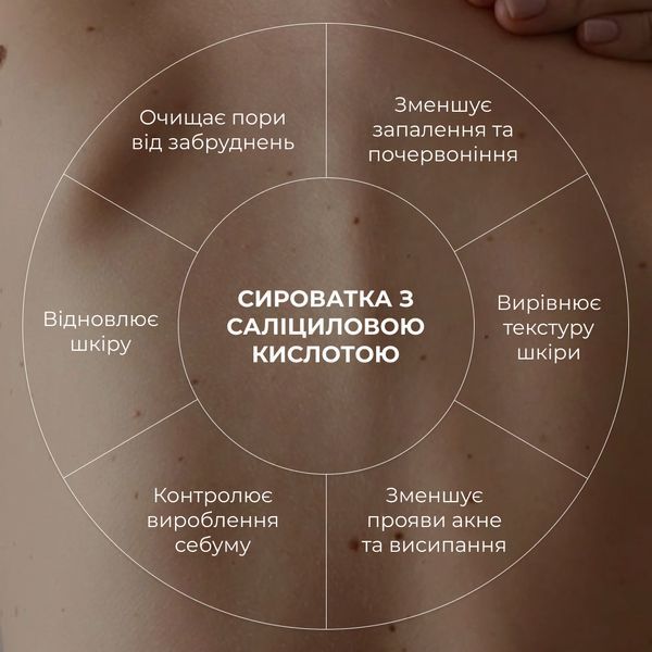 Сироватка для проблемної шкіри з саліциловою кислотою Hillary Back & Body Acne Control Serum, 50 мл HI-08-836 фото