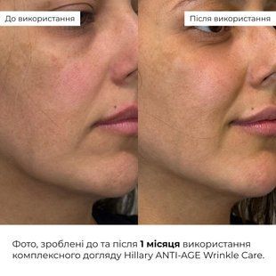 Комплексний догляд Hillary ANTI-AGE Wrinkle Сare HI-11-797 фото