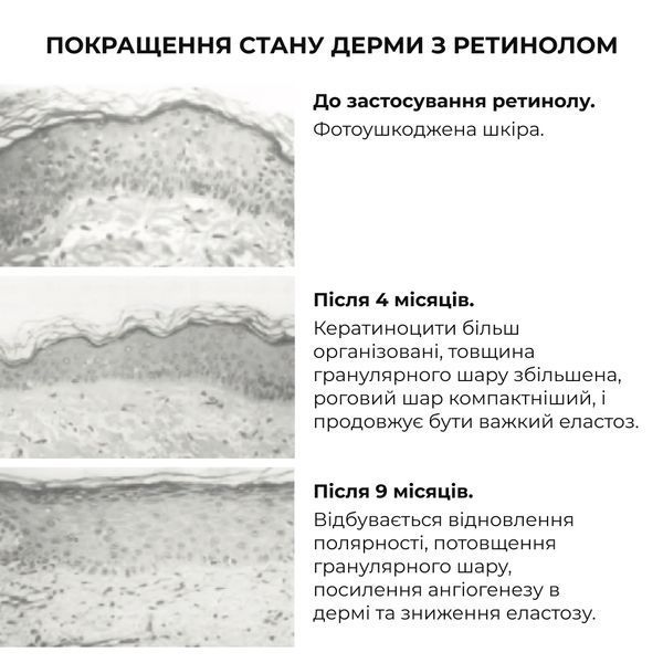 Сироватка для активного відновлення шкіри Hillary ReNuAge Retinol Active Renewal Serum, 30 мл HI-08-711 фото