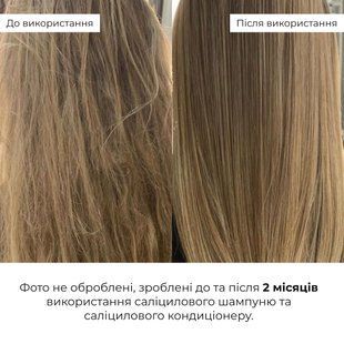 Саліциловий кондиціонер для відновлення волосся Hillary Salicylic Hair Reset Conditioner, 400 мл HI-07-669 фото