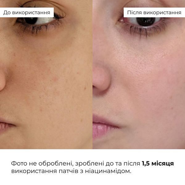 Мультифункціональні та заспокійливі патчі Hillary Niacinamide & Centella K2-11-458 фото