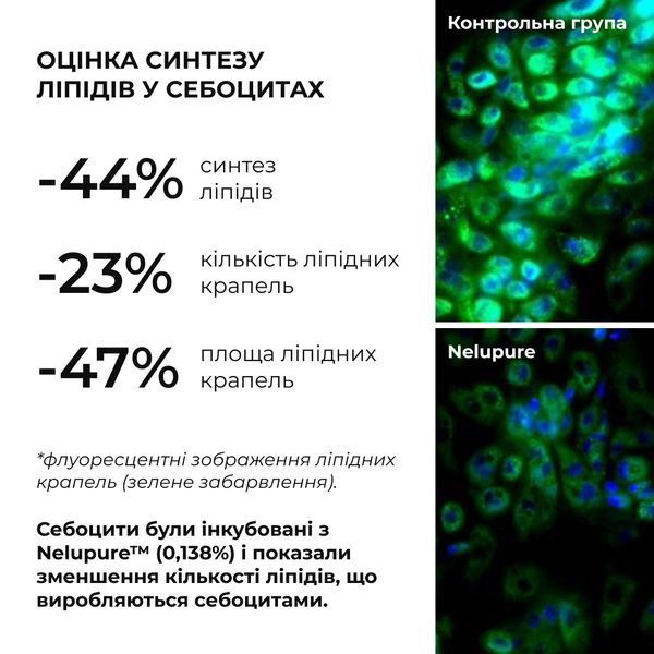 Набір себорегулюючого догляду для жирної та проблемної шкіри обличчя Hillary for oily and problematic skin K2-11-309 фото