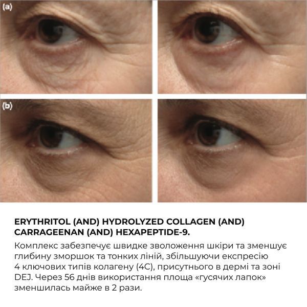 Крем для комплексного омолодження шкіри навколо очей Hillary ReNuAge Time Warp Eye Cream, 15 мл HI-08-793 фото
