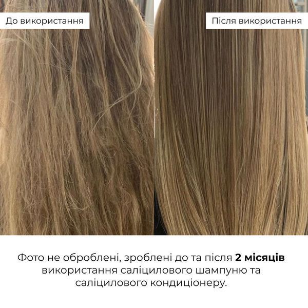 Комплект для глибокого очищення та відновлення волосся і шкіри голови Hillary Deep Cleanse & Hair Restoration Set K-11-998 фото