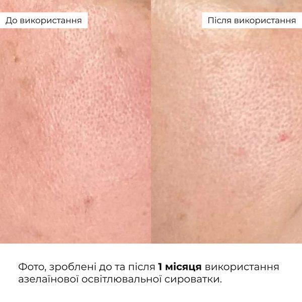 Комплекс для сяйва й захисту шкіри SPF30 Hillary Brightening and Skin Protection Complex K-11-033 фото