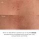 Очищувальний гель для тіла з саліциловою кислотою Hillary Anti-Acne Salicylic Body Wash, 200 мл HI-01-427 фото 5