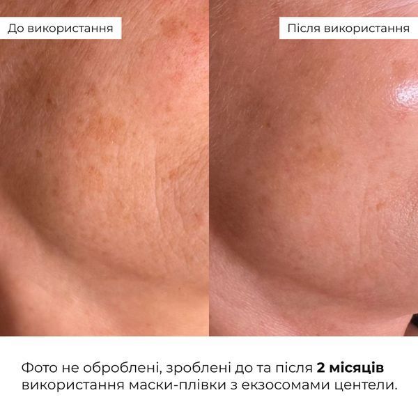 Набір для пружності та зволоження шкіри обличчя Hillary Skin Hydration & Firming Kit K-11-132 фото