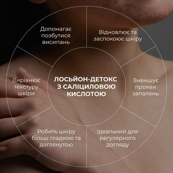 Лосьйон-детокс для проблемної шкіри з саліциловою кислотою Hillary Anti-Acne Salicylic Body Lotion, 150 мл HI-08-957 фото