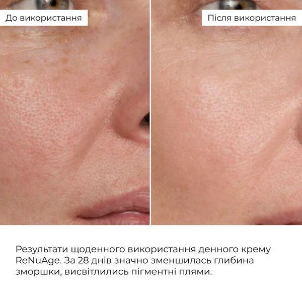 Набір денного ліфтинг-догляду ReNuAge Daytime Lifting Skincare Set K2-08-071 фото