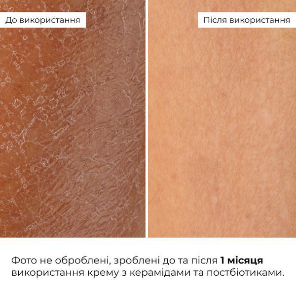 Набір для відновлення та освітлення чутливої шкіри Hillary Sensitive Skin Recovery & Glow Set K-11-685 фото
