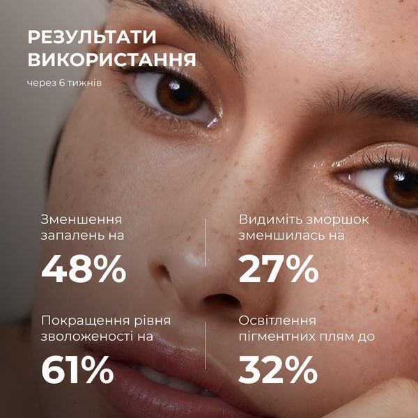 Набір для відновлення та освітлення чутливої шкіри Hillary Sensitive Skin Recovery & Glow Set K-11-685 фото
