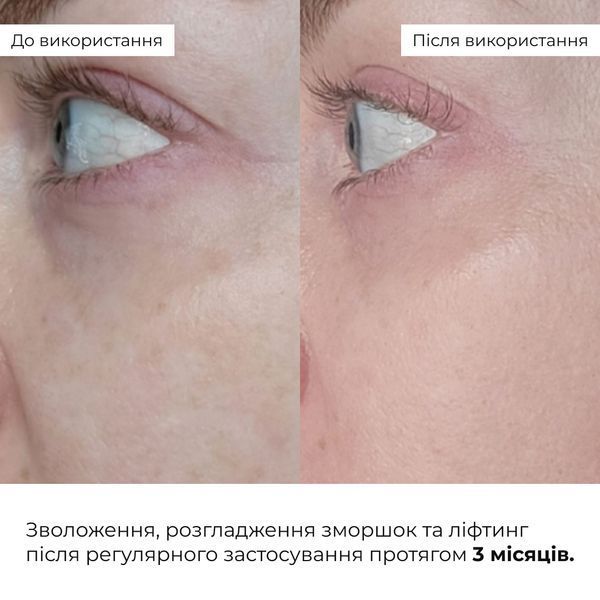 Антивіковий базовий догляд для обличчя Hillary Basic Anti-Aging Care K-11-812 фото
