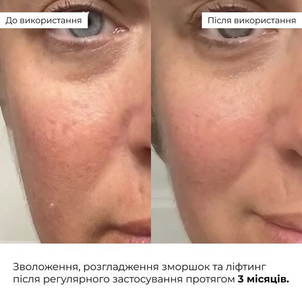 Антивіковий щоденний догляд за обличчям Hillary Daily Anti-Aging Care K-11-366 фото