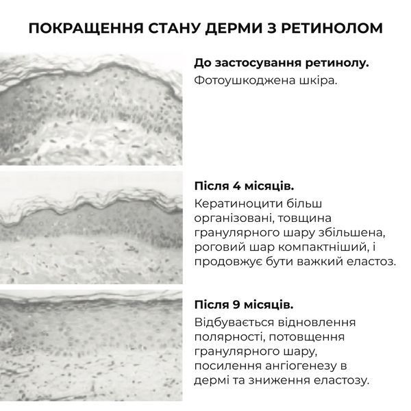 Комплекс нічного відновлення шкіри обличчя з ретинолом та пептидами ReNuAge Nighttime Skin Renewal Complex with Retinol and Peptides K2-08-415 фото