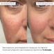 Антивіковий щоденний догляд за обличчям Hillary Daily Anti-Aging Care K-11-366 фото 2