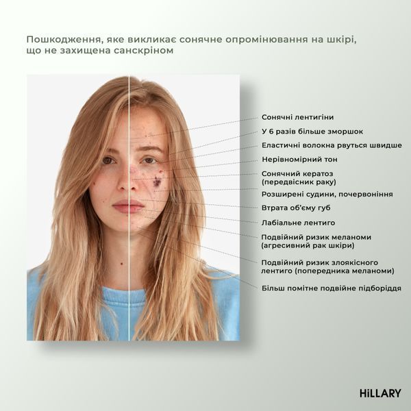 Набір для обличчя сонцезахисний та тонізуючий Hillary Sun protection and Toning K-11-165 фото