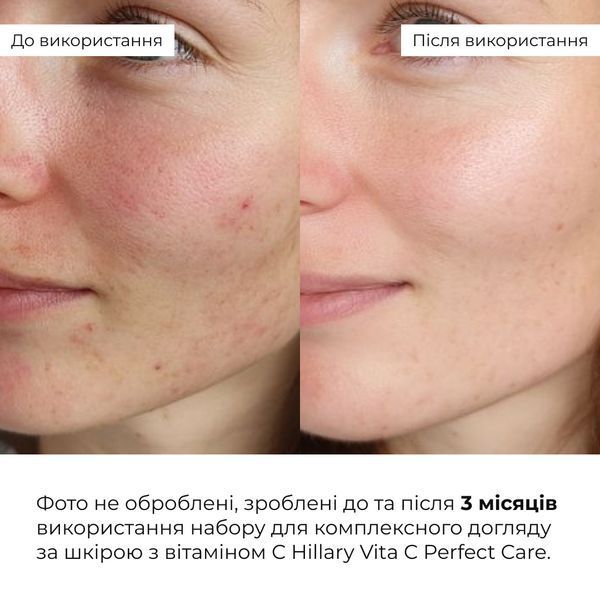 Набір для комплексного догляду за шкірою з вітаміном С Hillary Vitа С Perfect Care K-11-100 фото