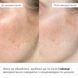 Комплекс для відновлення тону та захист від пігментації SPF 30 Hillary Tone Repair & Pigment Defense Set K-11-460 фото 2