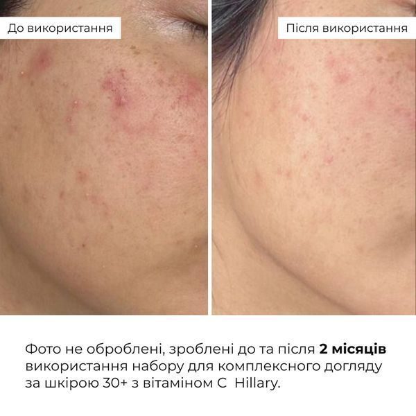 Набір для комплексного догляду за шкірою 30+ з вітаміном С Hillary Vitа С Perfect Care 30+ K-11-818 фото