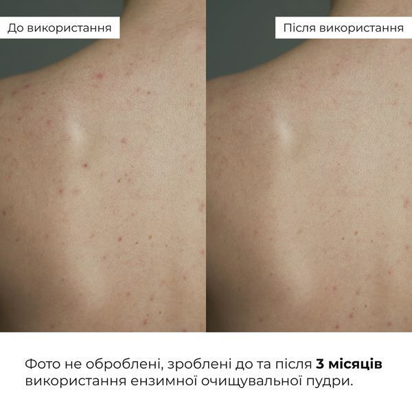 Ензимна очищувальна пудра для жирної та комбінованої шкіри HiLLARY Enzyme Balance Cleanser Powder , 40 г HI-08-520 фото