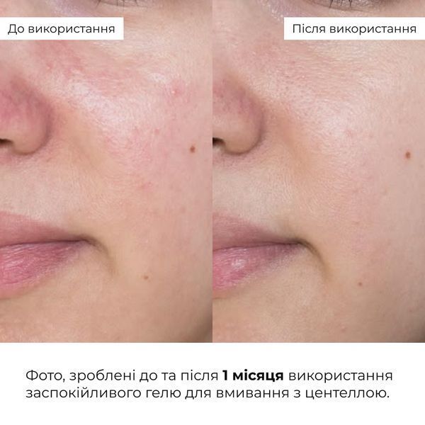 Набір заспокійливий з центеллою Hillary Centella Soothing Set K-11-320 фото