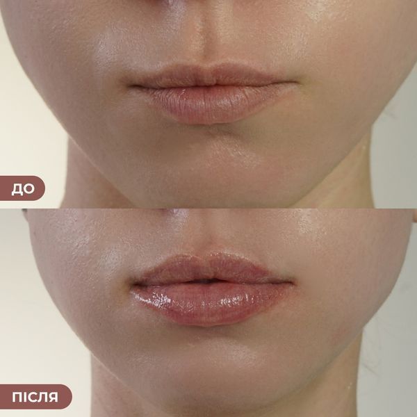 Набір проти сухості та для об&rsquo;єму губ Hillary Lip Hydration & Plumping Set K-11-944 фото